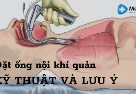 Ống Nội Khí Quản Là Gì? Quy Trình Kỹ Thuật Và Lưu Ý