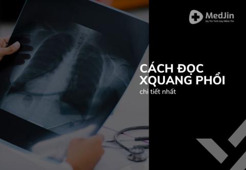 Cách Đọc X Quang Phổi Đơn Giản, Chính Xác Nhất 