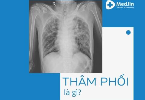 Thâm Nhiễm Phổi Là Gì? Nguyên Nhân Do Đâu? Ảnh Hưởng Như Thế Nào?