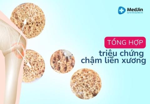 Tổng Hợp Triệu Chứng Chậm Liền Xương Đầy Đủ Nhất