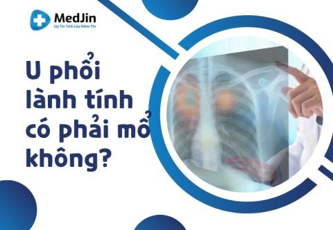 [Giải Đáp Thắc Mắc] U Phổi Lành Tính Có Phải Mổ Không?